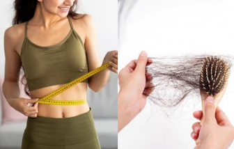 Rụng tóc do giảm cân và biện pháp cải thiện