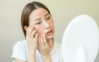 Làn da nhạy cảm hay bị nổi mẩn ngứa vào mùa hè, chăm sóc thế nào?