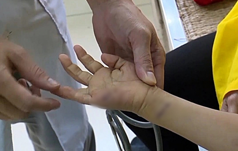 Thời tiết oi bức làm gia tăng nguy cơ lây truyền bệnh dại