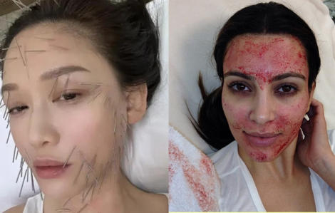 Những phương pháp làm đẹp gây tranh cãi của các ngôi sao