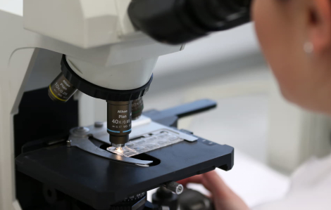 Trí tuệ nhân tạo có thể giúp giảm nguy cơ tử vong do ung thư tuyến tiền liệt