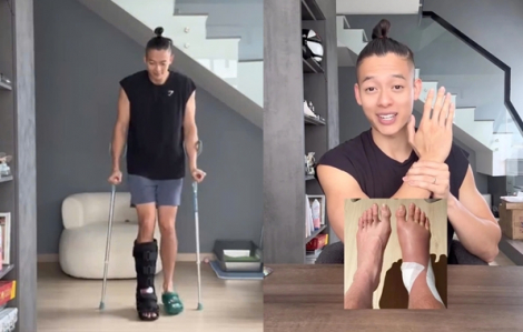 TikToker Trí Thịt Bòa bị gãy xương do chơi pickleball