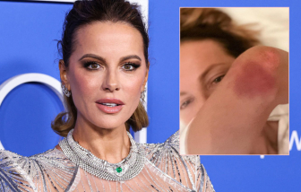 Ngôi sao Kate Beckinsale kiện nhà sản xuất vì bị tai nạn trường quay