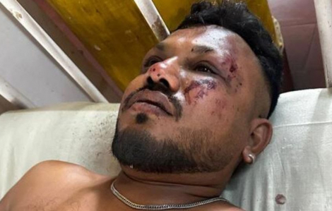 Người đàn ông Anh không biết mình sống sót thế nào sau vụ rơi máy bay