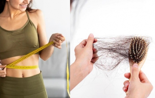 Rụng tóc do giảm cân và biện pháp cải thiện
