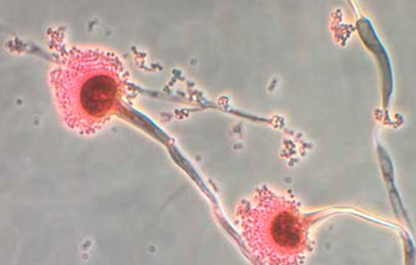 Nấm ăn thịt người đang xâm chiếm nước Mỹ