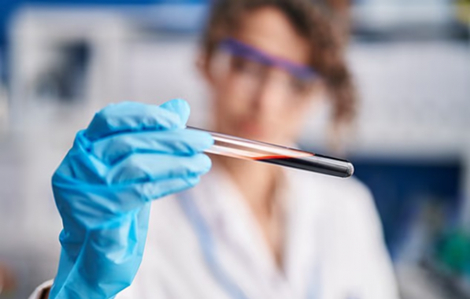 Ý nghiên cứu phương pháp xét nghiệm máu để phát hiện bệnh Alzheimer