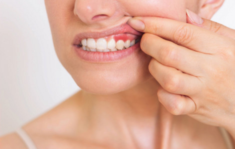 Chăm sóc nướu đúng cách: Giải pháp giúp mẹ bầu an tâm suốt thai kỳ