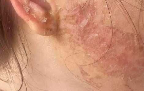 Khởi tố 2 đối tượng liên quan vụ một phụ nữ bị cắt tóc, xăm mặt ở Cà Mau