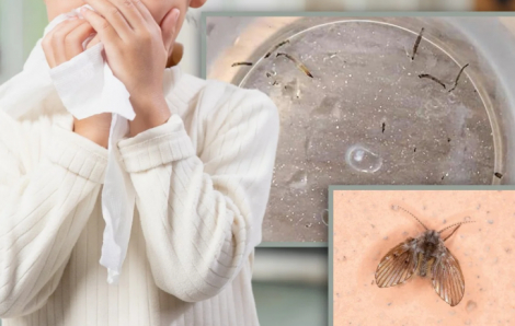 Bé gái 8 tuổi mỗi ngày đều nôn ra ấu trùng trong nhiều tháng