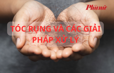 Infographic: Tóc rụng và các giải pháp xử lý