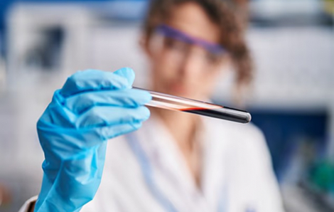 Ý nghiên cứu phương pháp xét nghiệm máu để phát hiện bệnh Alzheimer