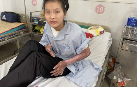 Nữ sinh bỏng nặng khi làm thời trang từ vật liệu tái chế