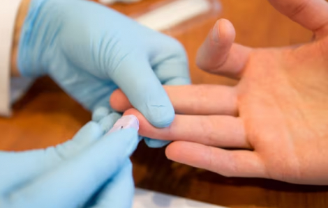 Các nước nghèo sẽ được tiếp cận thuốc phòng ngừa HIV