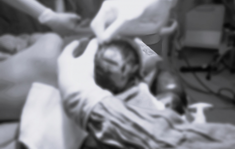 Bé trai 4 tuổi bị chó nhà cắn vào vùng đầu