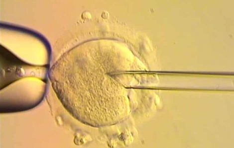 8 em bé khỏe mạnh chào đời bằng ADN của 3 người