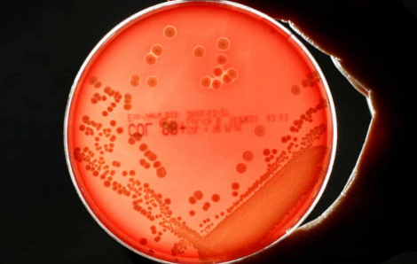 Siêu vi khuẩn có thể giết chết hàng triệu người 