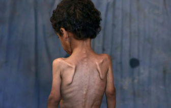 Trẻ em Gaza đang chết đói mỗi ngày