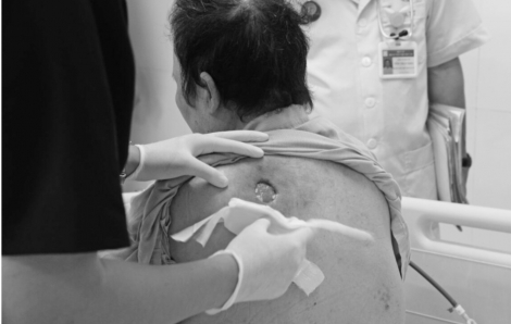 "Lấy độc trị độc", nữ bệnh nhân suýt chết vì uống nước đường trị tiểu đường