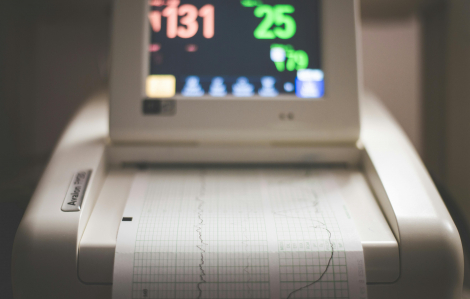 Thu hồi số công bố tiêu chuẩn của 36 thiết bị y tế, có cả máy điện tim, dung dịch nhỏ mắt