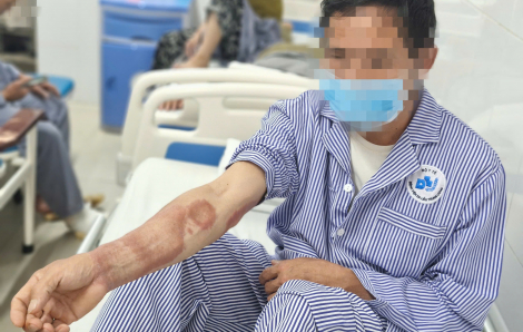 Tưởng viêm da, 2 cha con cùng mắc căn bệnh đang dần “quên lãng”