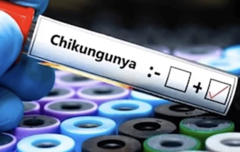 Bộ Y tế nói gì về nguy cơ dịch bệnh Chikungunya xâm nhập vào Việt Nam?