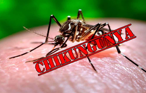 Làm gì để phòng ngừa bệnh Chikungunya?