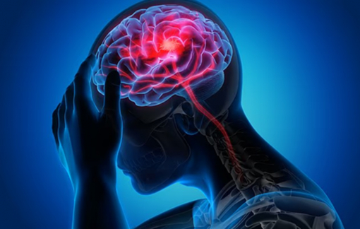 Phụ nữ từng bị biến chứng khi mang thai có nguy cơ cao bị đột quỵ trước 50 tuổi