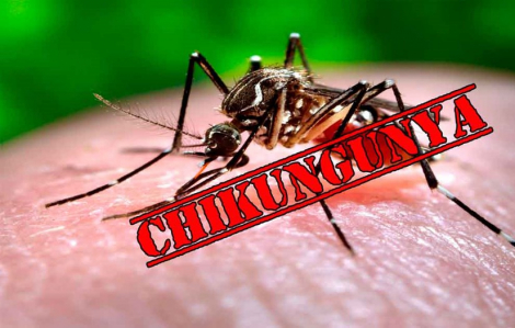 Làm gì để phòng ngừa bệnh Chikungunya?
