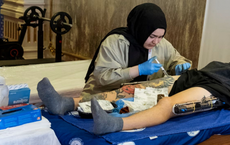 Hành trình đầy đau đớn để có được đôi chân dài mơ ước