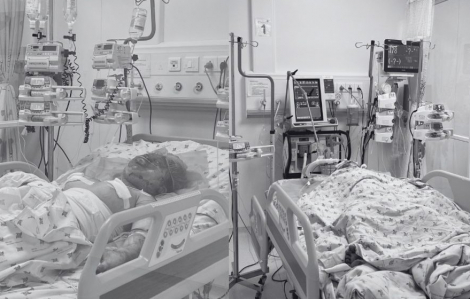 Trúng “bom xăng”, hai chị em ở Tây Ninh bị phỏng nặng