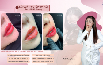 LANKA Beauty bật mí bí quyết sở hữu đôi môi căng bóng, tự nhiên không cần son phấn
