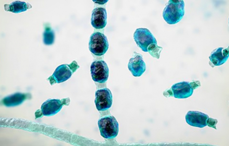 Nguy cơ đại dịch mới từ bệnh nấm gây nhiễm trùng phổi