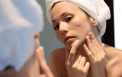 Cẩm nang chăm sóc da dầu, da nhạy cảm, da sẹo hiệu quả