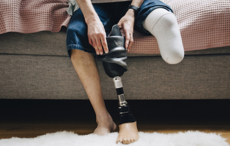 Khi chi không còn, "bản đồ cảm giác" vẫn nguyên vẹn