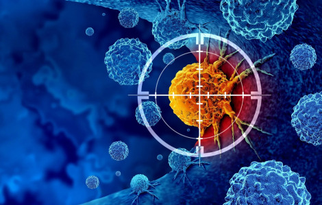 Tìm ra cách tiêu diệt tế bào ung thư vú “ngủ đông”