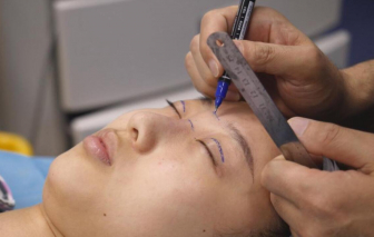 Giới trẻ Trung Quốc đổ xô phẫu thuật thẩm mỹ để theo đuổi 'vẻ đẹp lý tưởng'