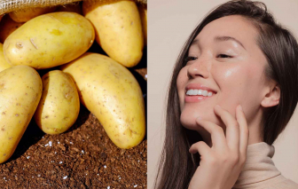 Làm đẹp từ gian bếp: Khoai tây giúp sáng da, giảm nếp nhăn