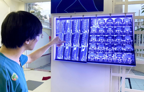 Làm sao tránh cong vẹo cột sống ở tuổi học đường?