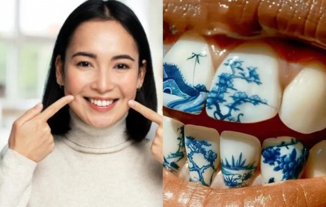 Giới trẻ Trung Quốc đua nhau xăm hình lên...răng