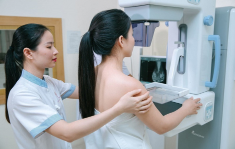 Ung thư vú chiếm hơn 25% trong tổng số các loại ung thư