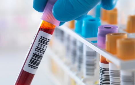 Anh phát triển phương pháp xét nghiệm máu để phát hiện hội chứng mệt mỏi mãn tính