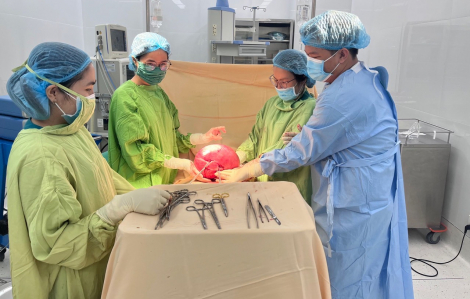 Thấy bụng to tưởng mang thai, đi khám mới biết bị u xơ khổng lồ