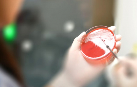 Kháng thuốc kháng sinh đang đảo lộn thành tựu y học