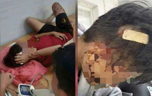 Công an vào cuộc điều tra nam sinh dùng gậy 3 khúc đánh vào đầu bạn