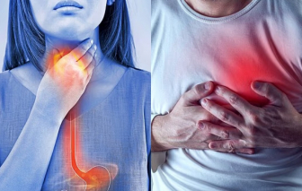 Trào ngược dạ dày làm tăng nguy cơ đau tim