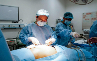 Cắt khối u dạ dày khổng lồ cho bệnh nhân bị trào ngược mạn tính