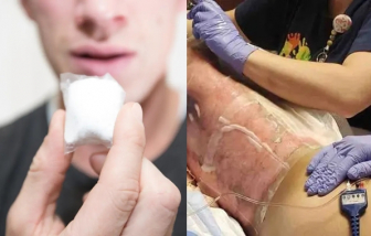 5 thử thách TikTok cướp đi hàng trăm sinh mạng