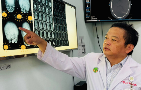 Bác sĩ thành công tạo hình xương sọ cho bé sơ sinh