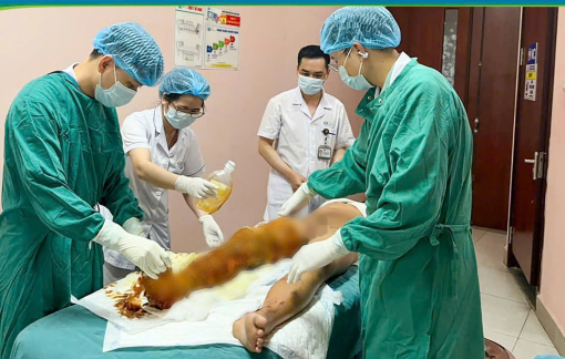 Thực hiện thí nghiệm đốt cồn, bé trai 12 tuổi bỏng nặng